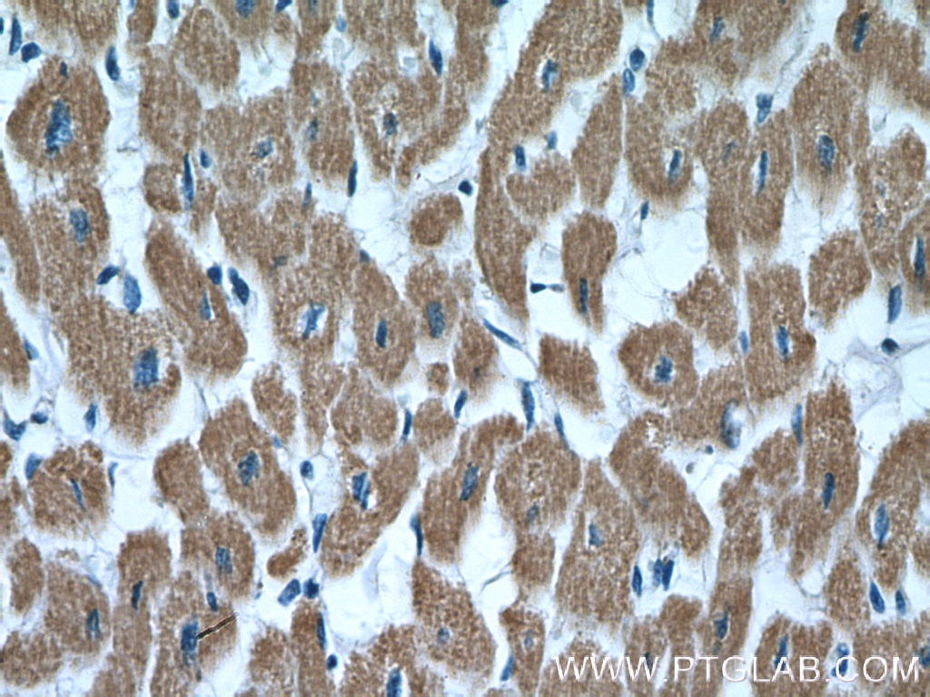 Immunohistochemistry (IHC) staining of human heart tissue using SDHB Polyclonal antibody (10620-1-AP)