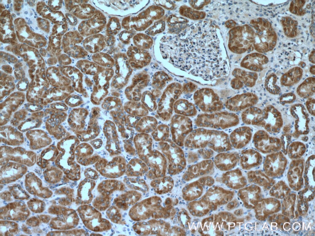 Immunohistochemistry (IHC) staining of human kidney tissue using SDHB Polyclonal antibody (10620-1-AP)