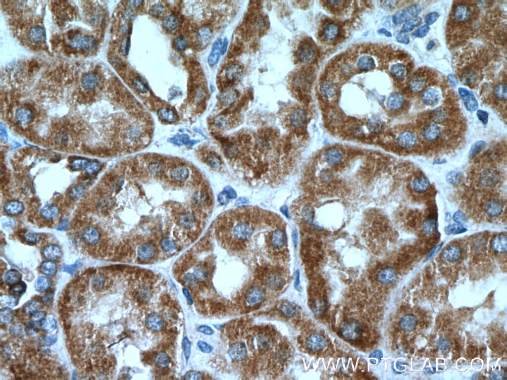Immunohistochemistry (IHC) staining of human kidney tissue using SDHB Polyclonal antibody (10620-1-AP)