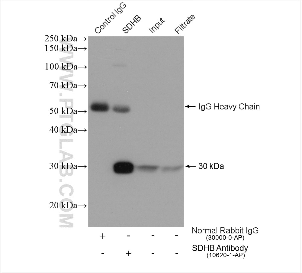 Immunoprecipitation (IP) experiment of HEK-293 cells using SDHB Polyclonal antibody (10620-1-AP)