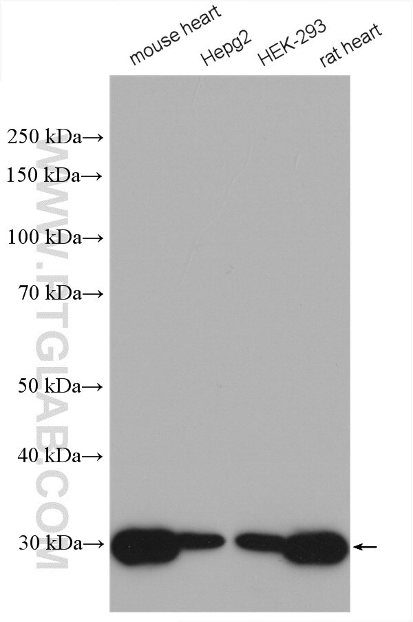 Western Blot (WB) analysis of various lysates using SDHB Polyclonal antibody (10620-1-AP)