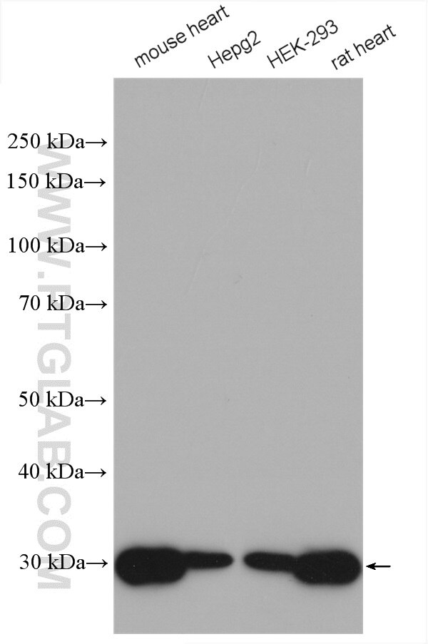 Western Blot (WB) analysis of various lysates using SDHB Polyclonal antibody (10620-1-AP)