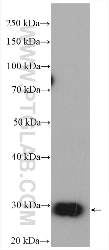 Western Blot (WB) analysis of mouse liver tissue using SDHB Polyclonal antibody (10620-1-AP)