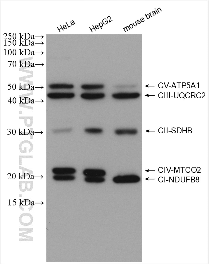 Western Blot (WB) analysis of various lysates using SDHB Polyclonal antibody (10620-1-AP)