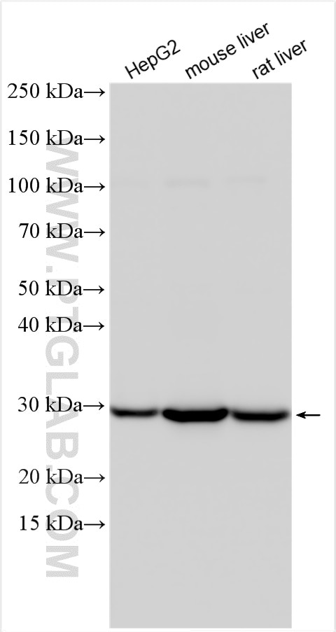 Western Blot (WB) analysis of various lysates using SDHB Polyclonal antibody (10620-1-AP)