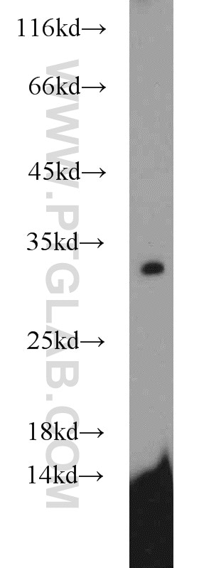 SDHB Polyclonal antibody