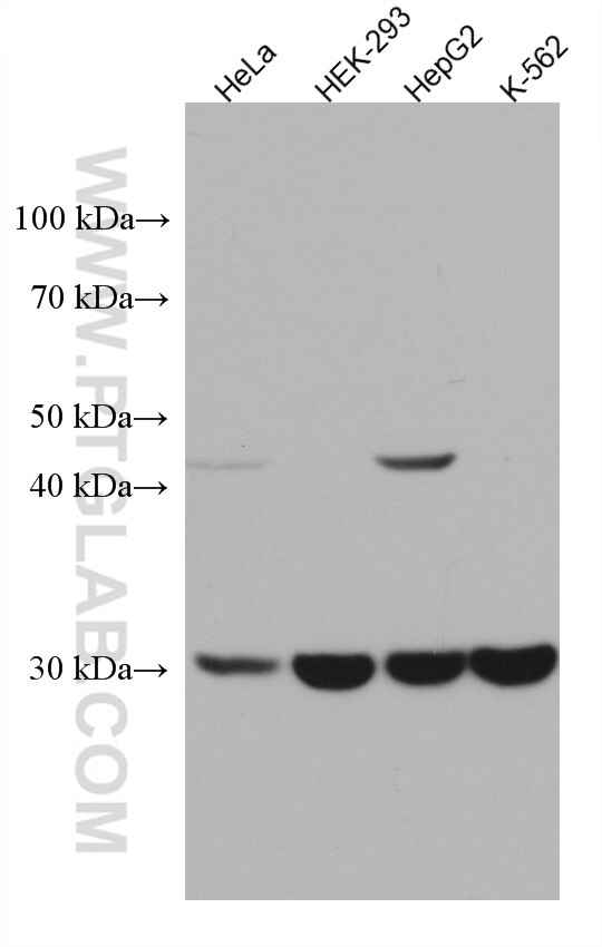 Western Blot (WB) analysis of various lysates using SDHB Monoclonal antibody (67600-1-Ig)
