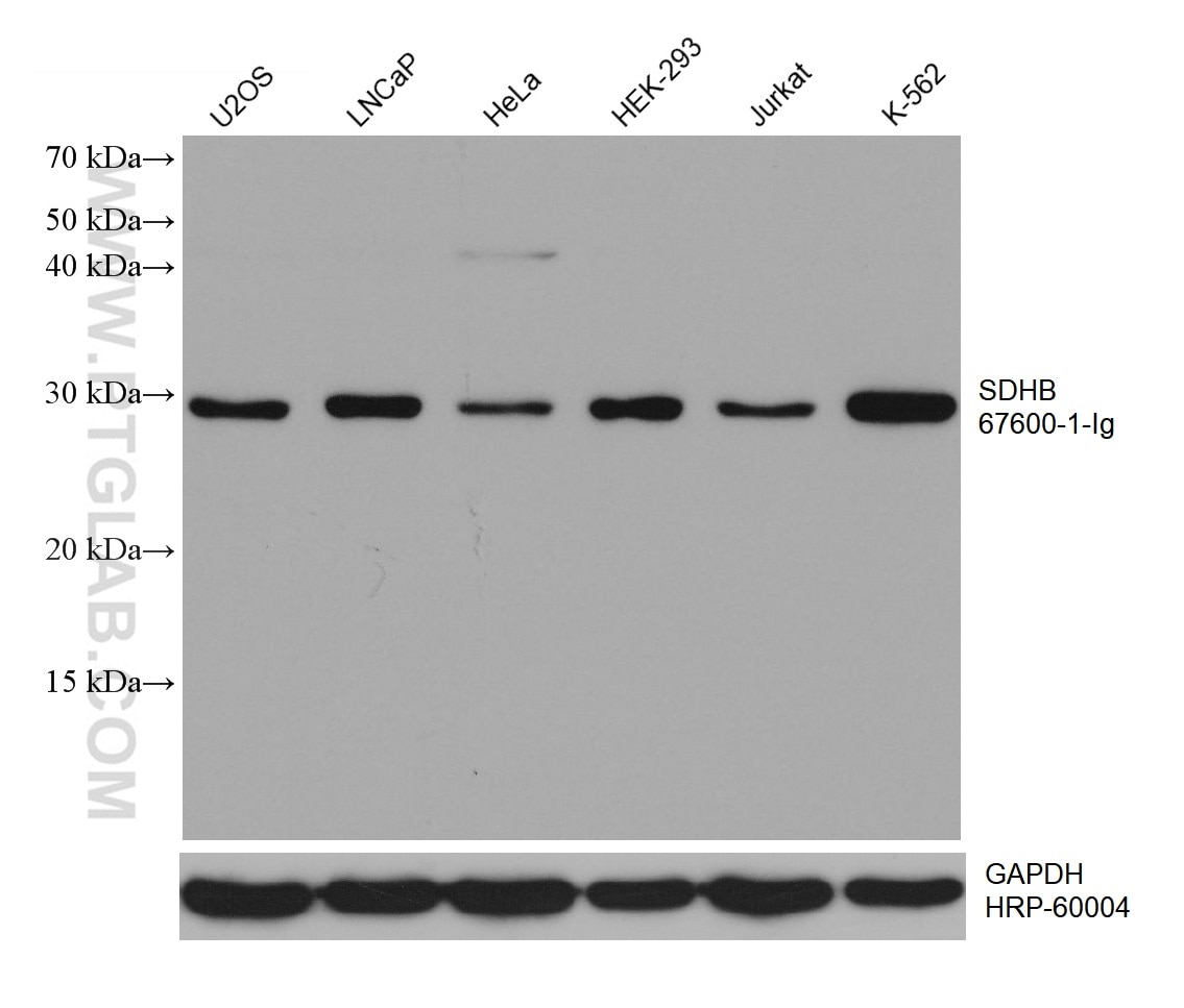 Western Blot (WB) analysis of various lysates using SDHB Monoclonal antibody (67600-1-Ig)