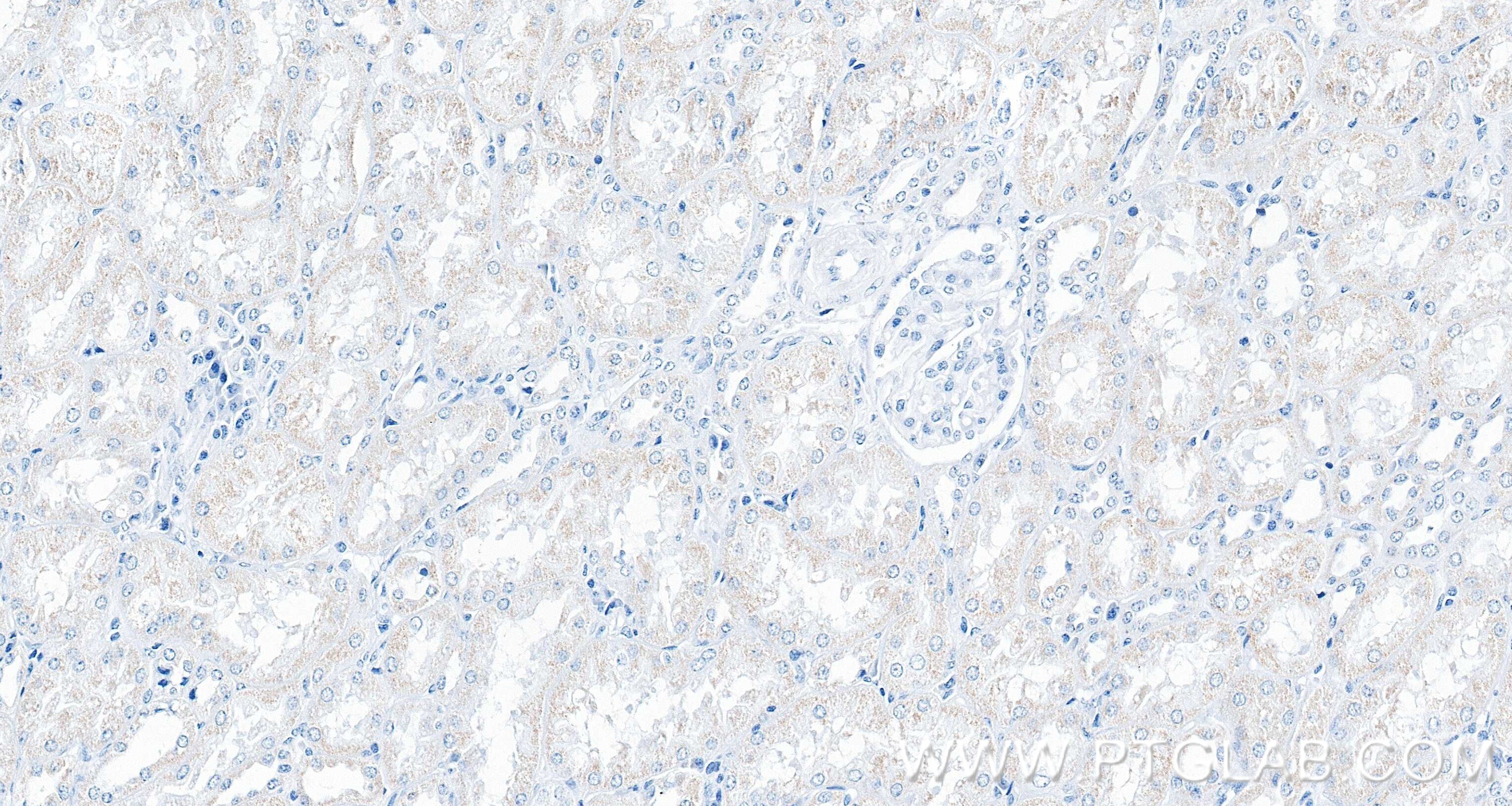 Immunohistochemistry (IHC) staining of human kidney tissue using SDHB Recombinant monoclonal antibody (87791-1-RR)