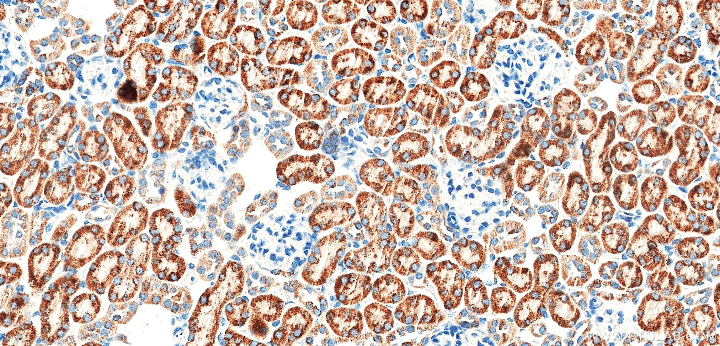 IHC staining of mouse kidney using 87791-1-RR Immunohistochemistry (IHC) staining of mouse kidney tissue using SDHB Recombinant monoclonal antibody (87791-1-RR)