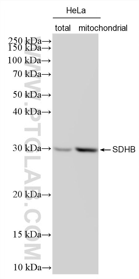 WB analysis using 87791-1-RR Western Blot (WB) analysis of various lysates using SDHB Recombinant monoclonal antibody (87791-1-RR)