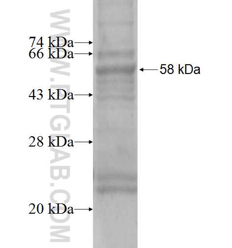 SDHB fusion protein Ag0968 SDS-PAGE