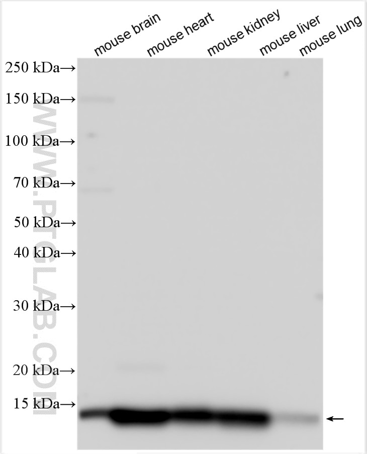 Western Blot (WB) analysis of various lysates using SDHC Polyclonal antibody (14575-1-AP)