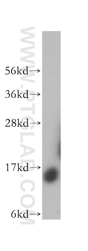 Western Blot (WB) analysis of human liver tissue using SDHC Polyclonal antibody (14575-1-AP)