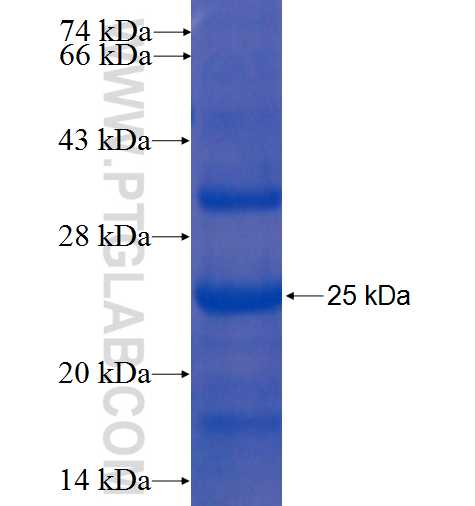 SDHC fusion protein Ag5775 SDS-PAGE