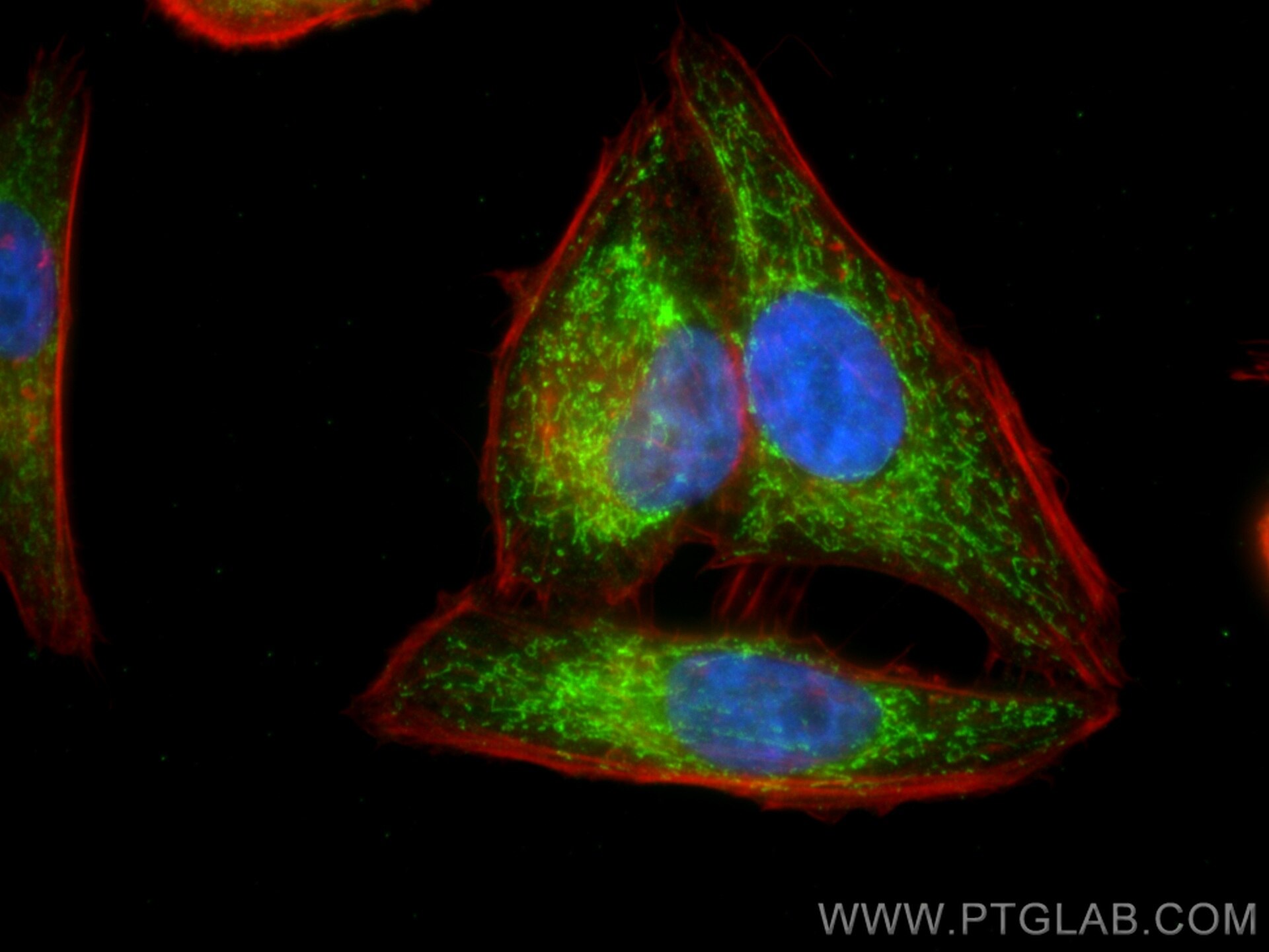 IF Staining of HepG2 using 26519-1-AP