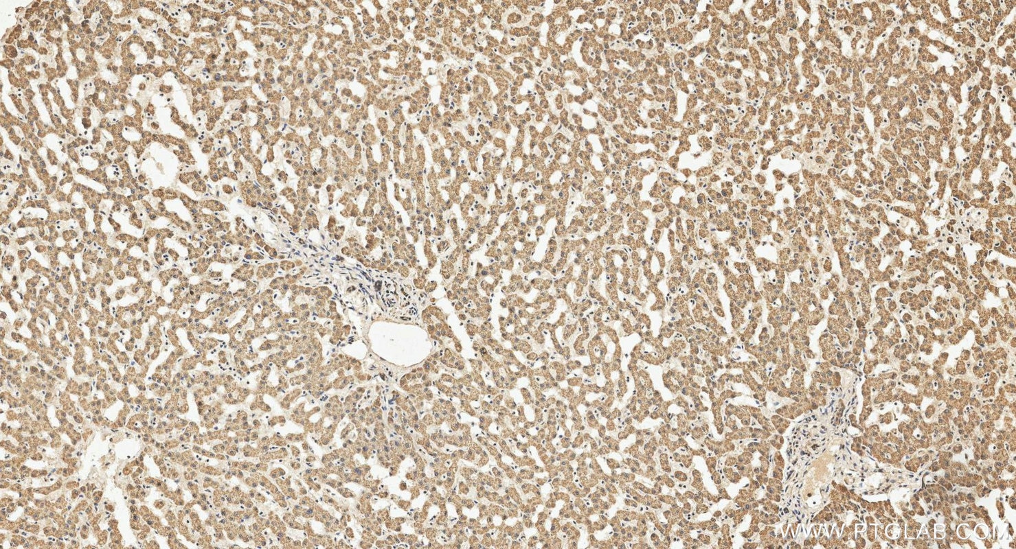 Immunohistochemistry (IHC) staining of human liver tissue using SDHD Polyclonal antibody (26519-1-AP)