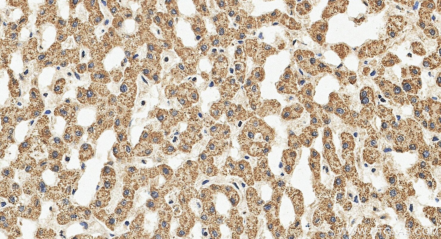 Immunohistochemistry (IHC) staining of human liver tissue using SDHD Polyclonal antibody (26519-1-AP)