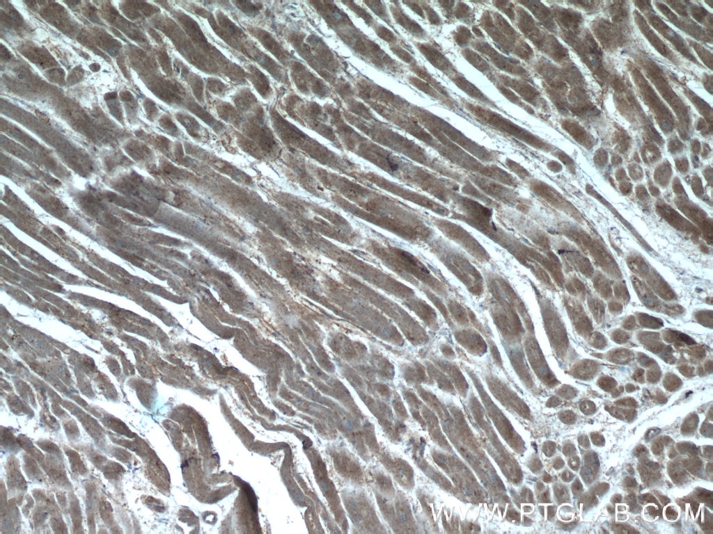 Immunohistochemistry (IHC) staining of human heart tissue using SDPR Polyclonal antibody (12339-1-AP)
