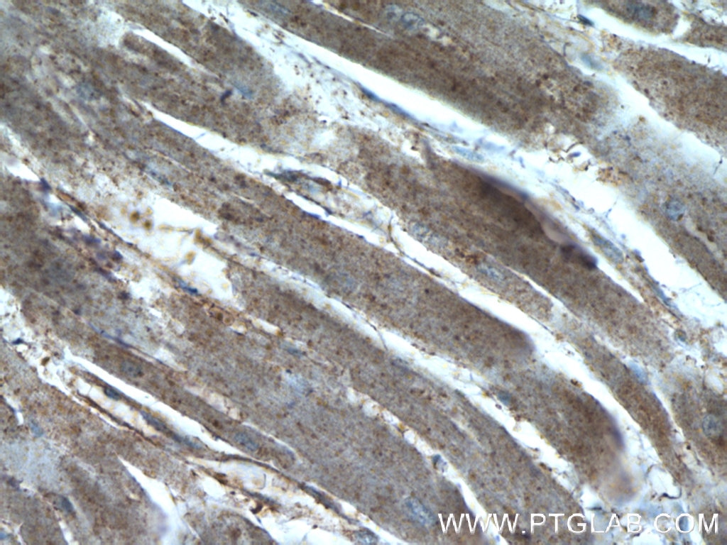 Immunohistochemistry (IHC) staining of human heart tissue using SDPR Polyclonal antibody (12339-1-AP)