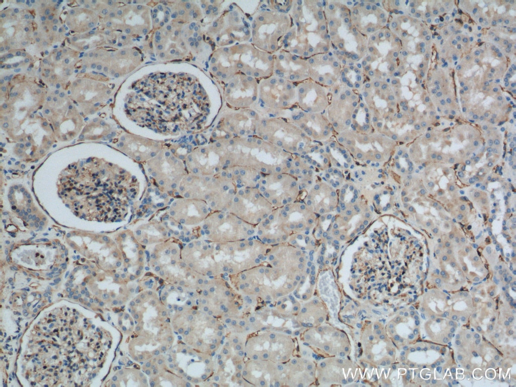 Immunohistochemistry (IHC) staining of human kidney tissue using SDPR Polyclonal antibody (12339-1-AP)