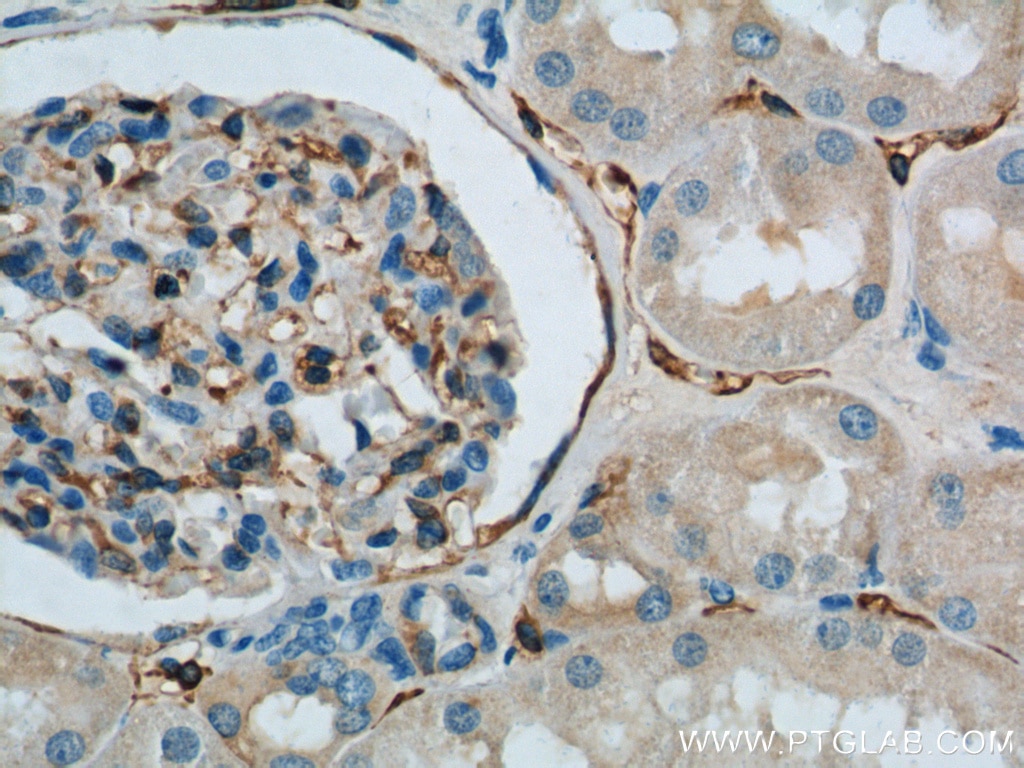 Immunohistochemistry (IHC) staining of human kidney tissue using SDPR Polyclonal antibody (12339-1-AP)