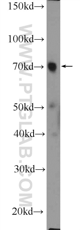 Western Blot (WB) analysis of rat brain tissue using SDPR Polyclonal antibody (12339-1-AP)