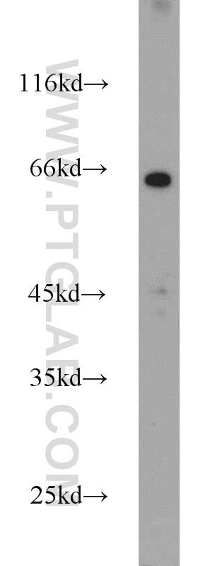 Western Blot (WB) analysis of mouse placenta tissue using SDPR Polyclonal antibody (12339-1-AP)