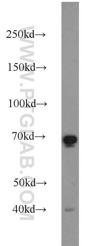 Western Blot (WB) analysis of COLO 320 cells using SDPR Polyclonal antibody (12339-1-AP)