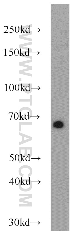 Western Blot (WB) analysis of mouse heart tissue using SDPR Polyclonal antibody (12339-1-AP)