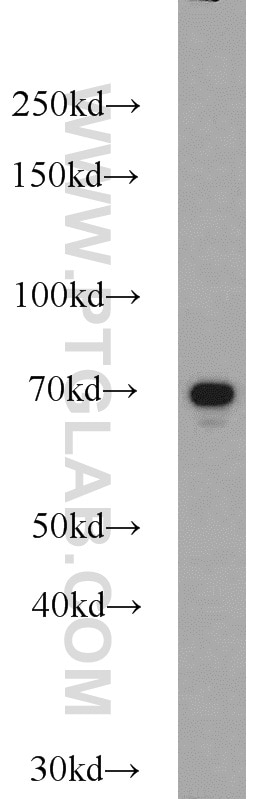 Western Blot (WB) analysis of A549 cells using SDPR Polyclonal antibody (12339-1-AP)