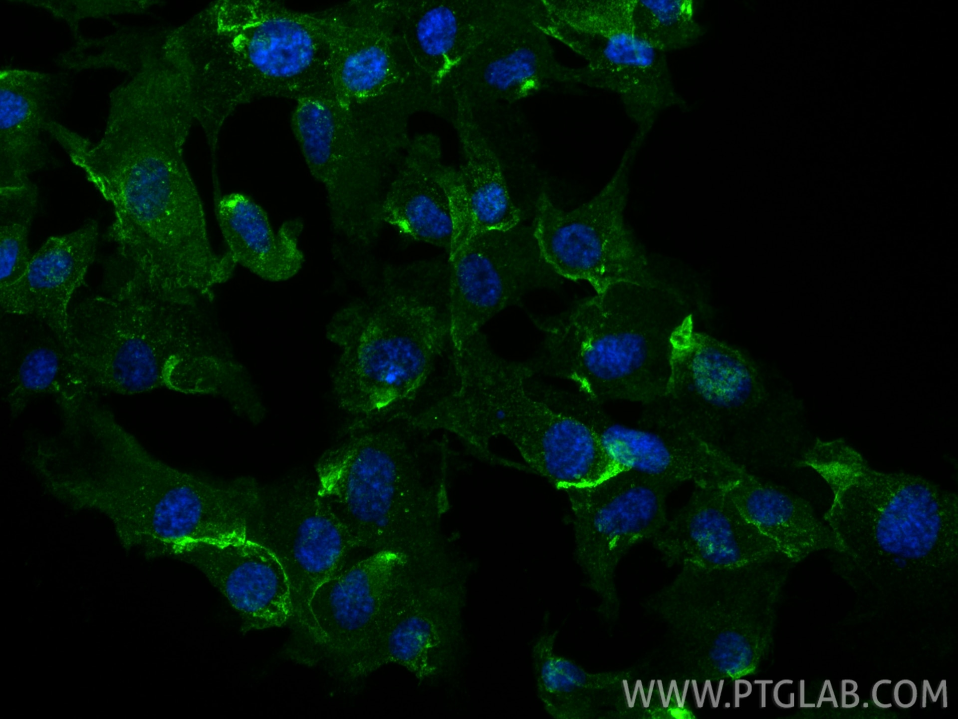 Immunofluorescence (IF) / fluorescent staining of HUVEC cells using SDPR Monoclonal antibody (61031-3-Ig)