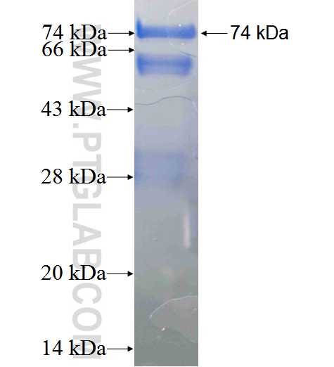 SDPR fusion protein Ag2990 SDS-PAGE
