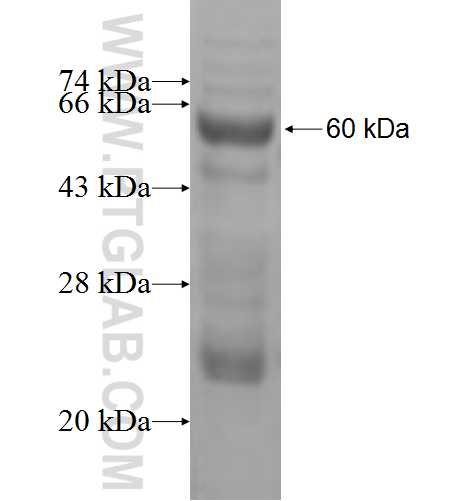 SDR16C5 fusion protein Ag5261 SDS-PAGE