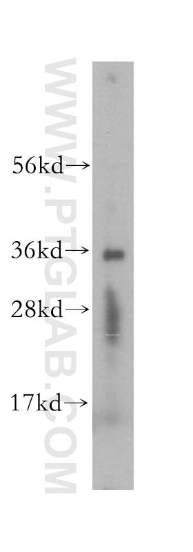 Western Blot (WB) analysis of human adrenal gland tissue using SDR39U1 Polyclonal antibody (16585-1-AP)