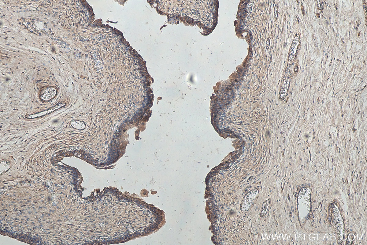 Immunohistochemistry (IHC) staining of human bladder tissue using SDR42E1 Polyclonal antibody (17347-1-AP)
