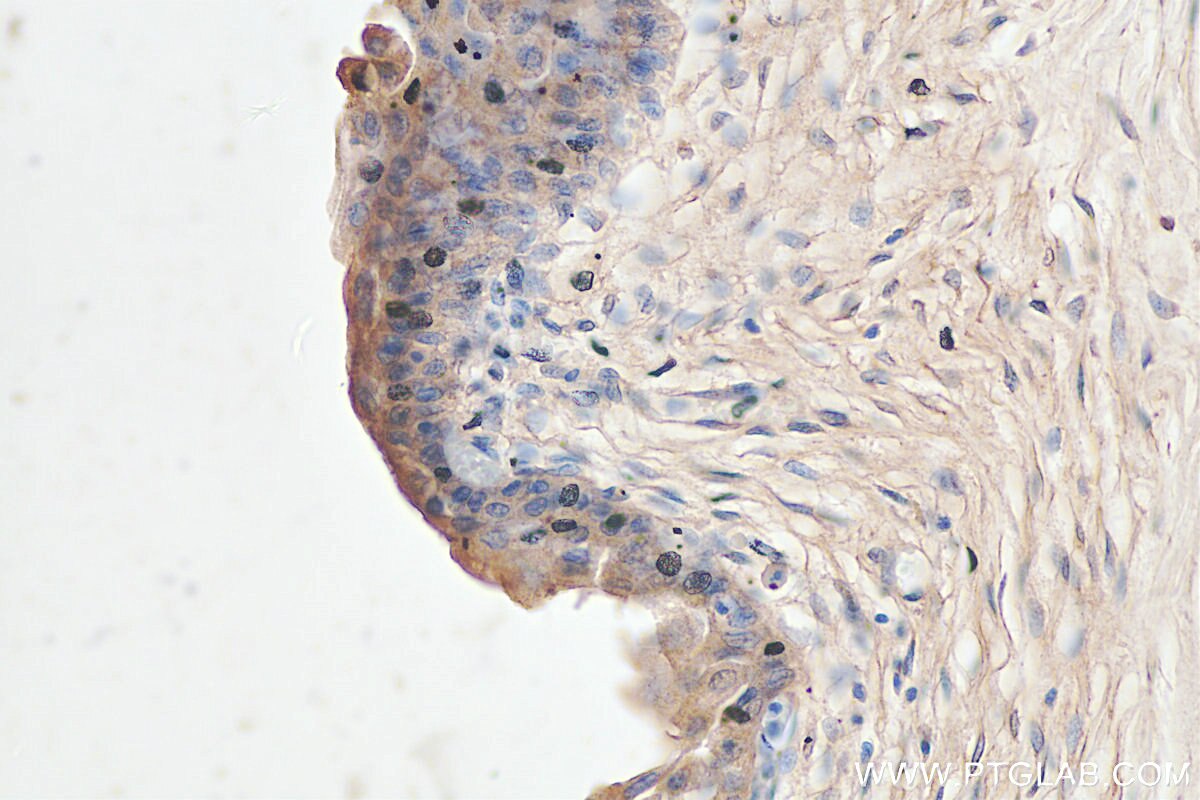 Immunohistochemistry (IHC) staining of human bladder tissue using SDR42E1 Polyclonal antibody (17347-1-AP)