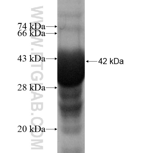 SDR42E1 fusion protein Ag11395 SDS-PAGE