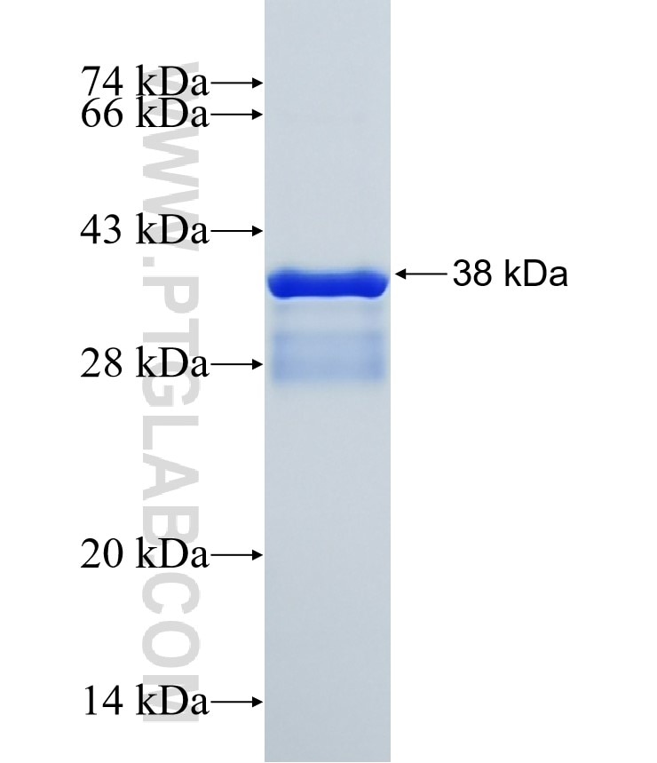 SDR9C7 fusion protein Ag20121 SDS-PAGE SDR9C7 fusion protein Ag20121 SDS-PAGE
