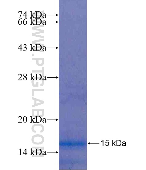 SDR9C7 fusion protein Ag20247 SDS-PAGE SDR9C7 fusion protein Ag20247 SDS-PAGE