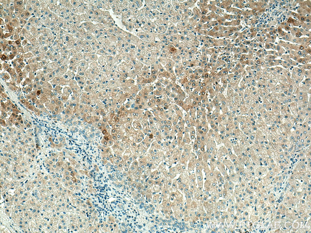 Immunohistochemistry (IHC) staining of human liver tissue using SDS Polyclonal antibody (16594-1-AP)