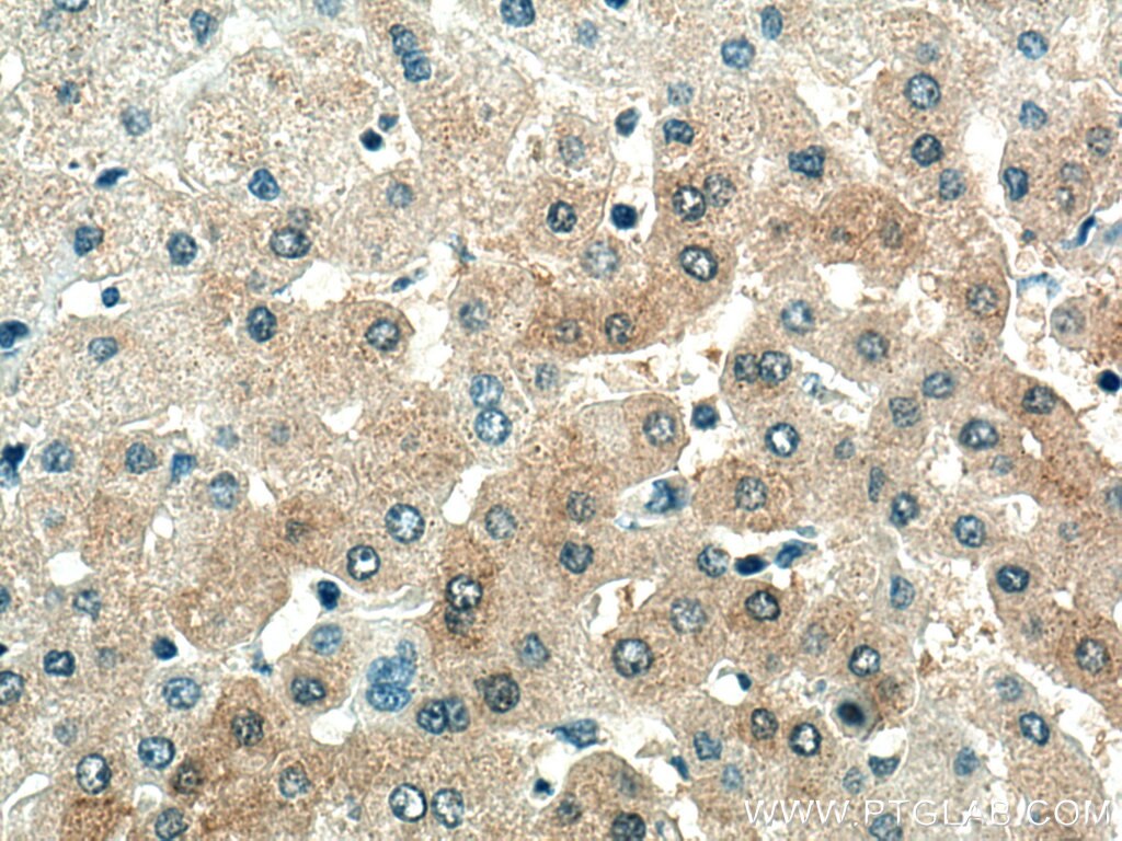 Immunohistochemistry (IHC) staining of human liver tissue using SDS Polyclonal antibody (16594-1-AP)