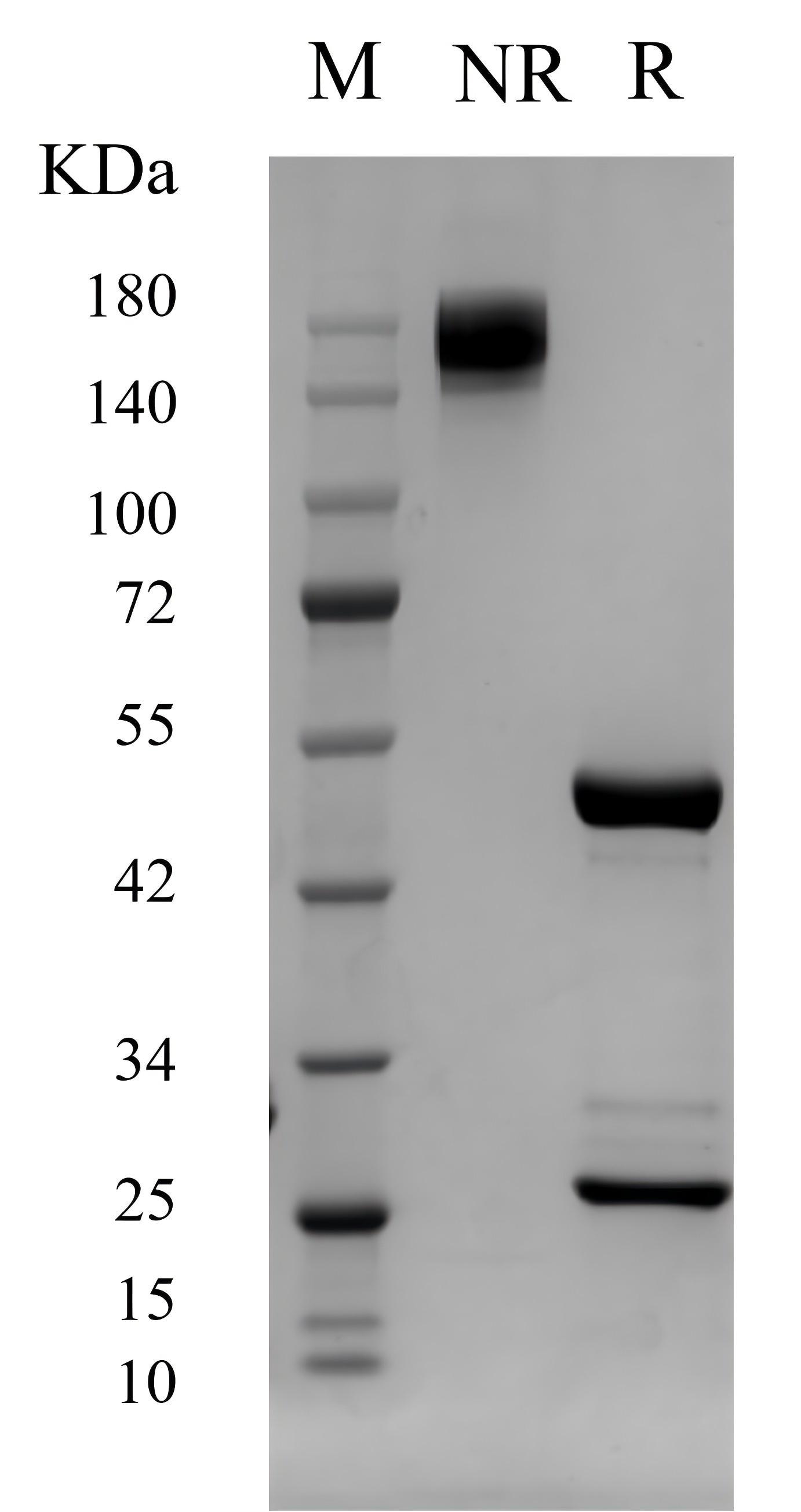 SDS-PAGE of BK00002