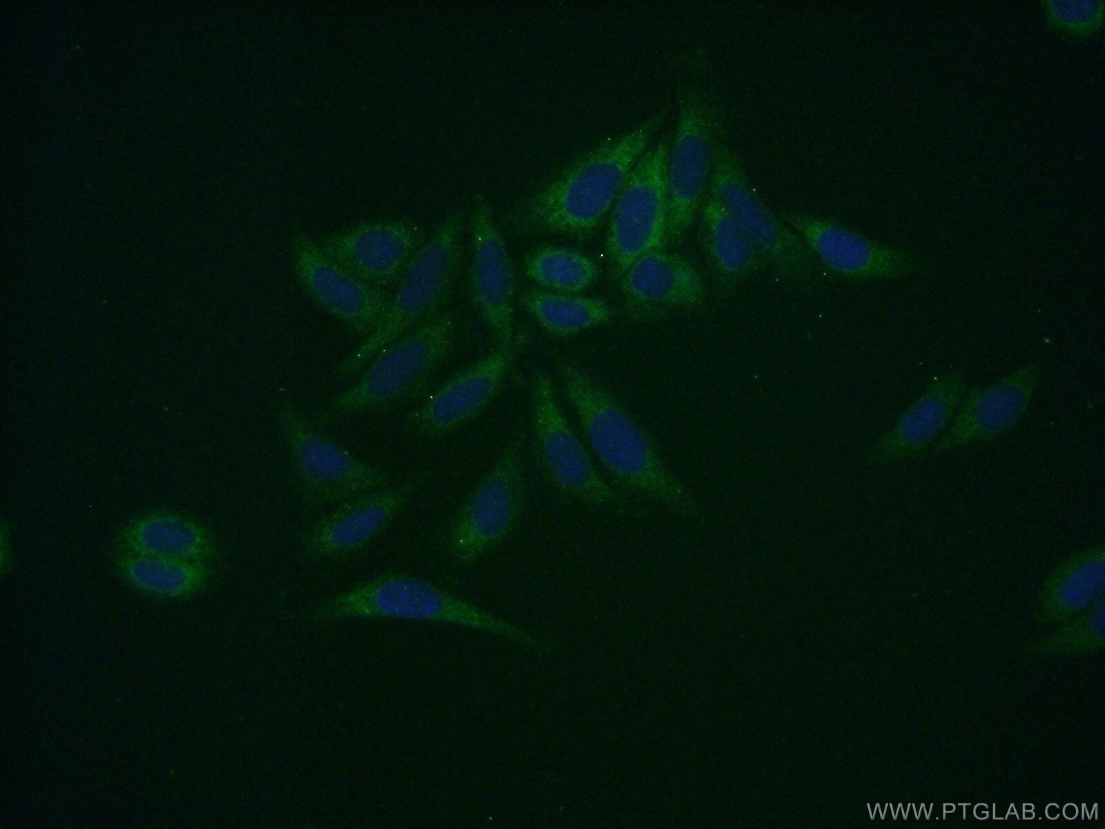 Immunofluorescence (IF) / fluorescent staining of HepG2 cells using SDSL Polyclonal antibody (16242-1-AP)