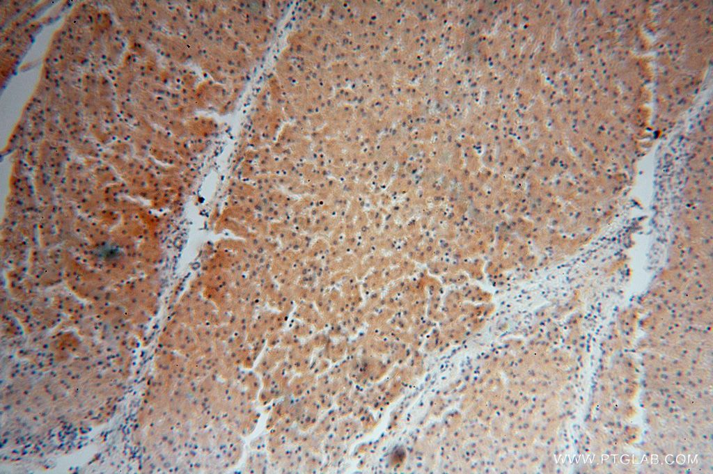 IHC staining of human liver using 16242-1-AP