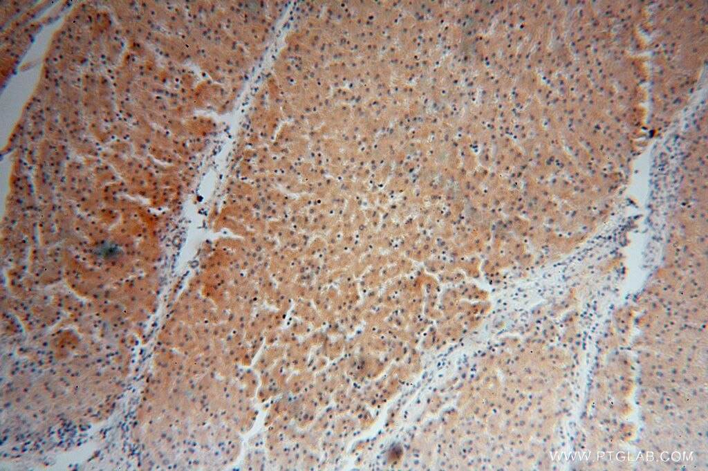 Immunohistochemistry (IHC) staining of human liver tissue using SDSL Polyclonal antibody (16242-1-AP)