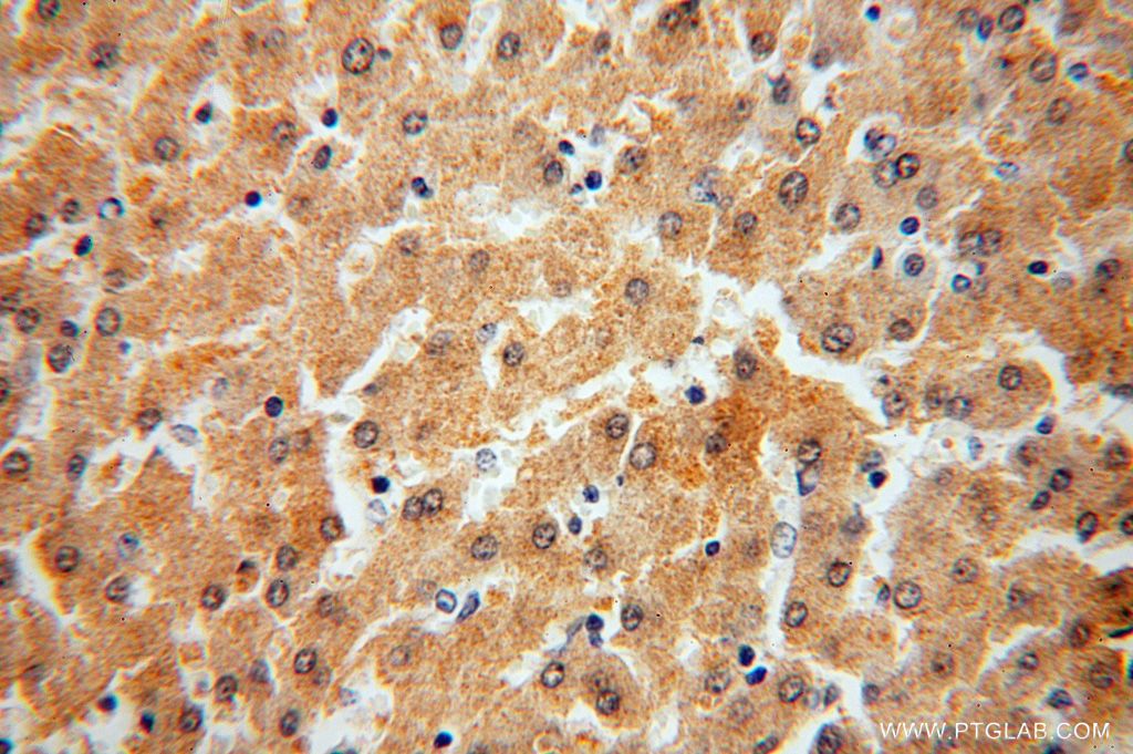 Immunohistochemistry (IHC) staining of human liver tissue using SDSL Polyclonal antibody (16242-1-AP)