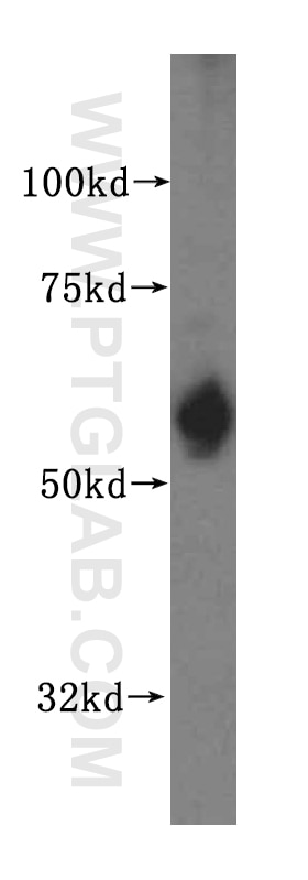 Western Blot (WB) analysis of HepG2 cells using SDSL Polyclonal antibody (16242-1-AP)