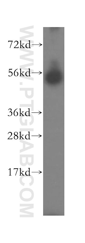 Western Blot (WB) analysis of human liver tissue using SDSL Polyclonal antibody (16242-1-AP)