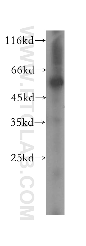 Western Blot (WB) analysis of human colon tissue using SDSL Polyclonal antibody (16242-1-AP)